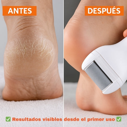 Dile Adiós a los Talones Agrietados – Exfoliador Recargable